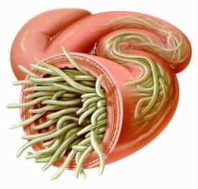 Parasites dans les intestins