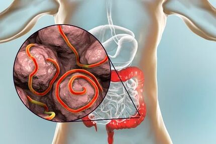 Parasites dans les intestins