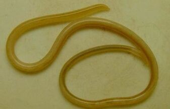 types de parasites dans le corps humain