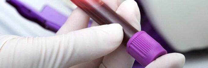 sang pour tests parasitaires